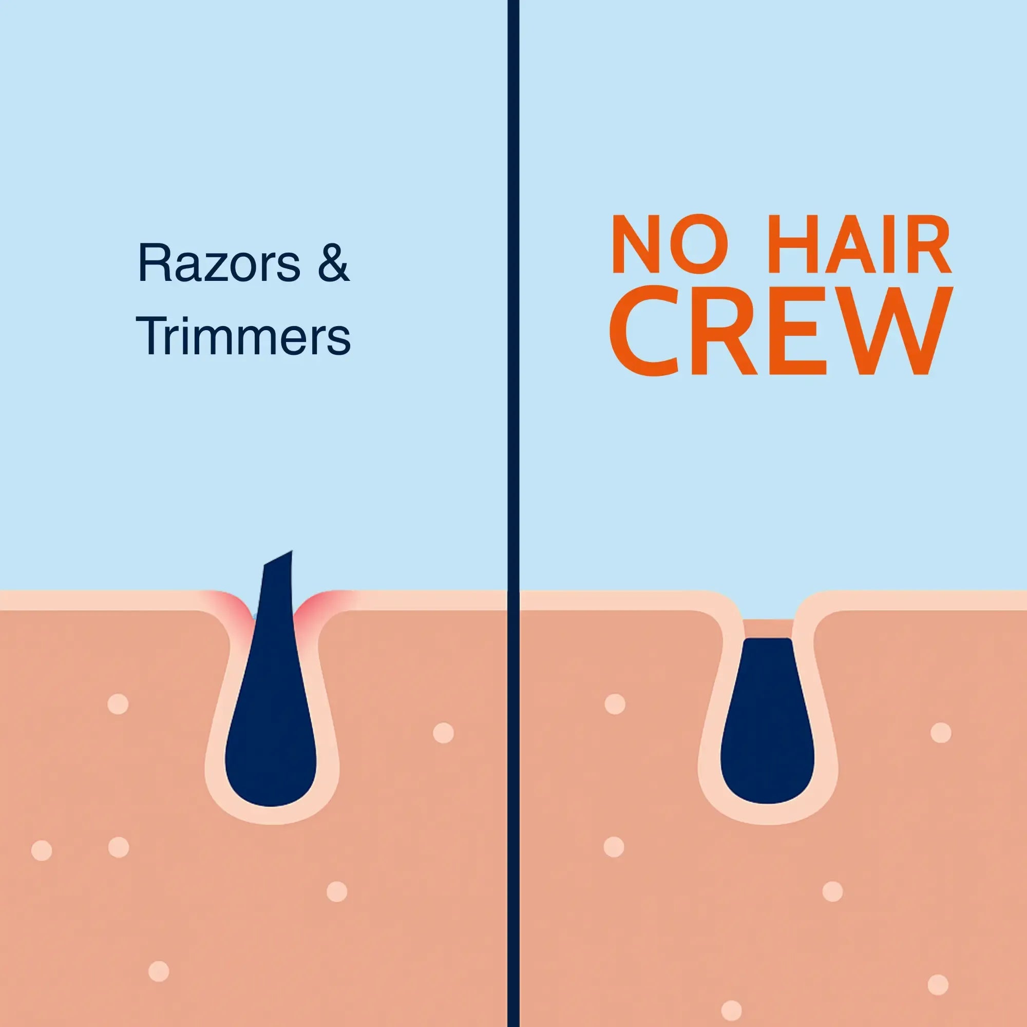 No Hair Crew INTIMATE Hair Removal Cream for Men - Gentle Foam Formula, 100ml, Dermatologically Tested, Fast Action, Body Care Cosmetic